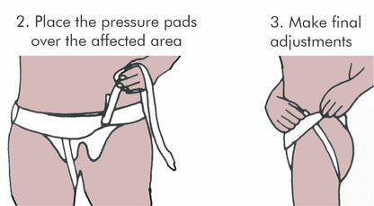 Inguinal Hernia Support Belt - Body Assist (1)