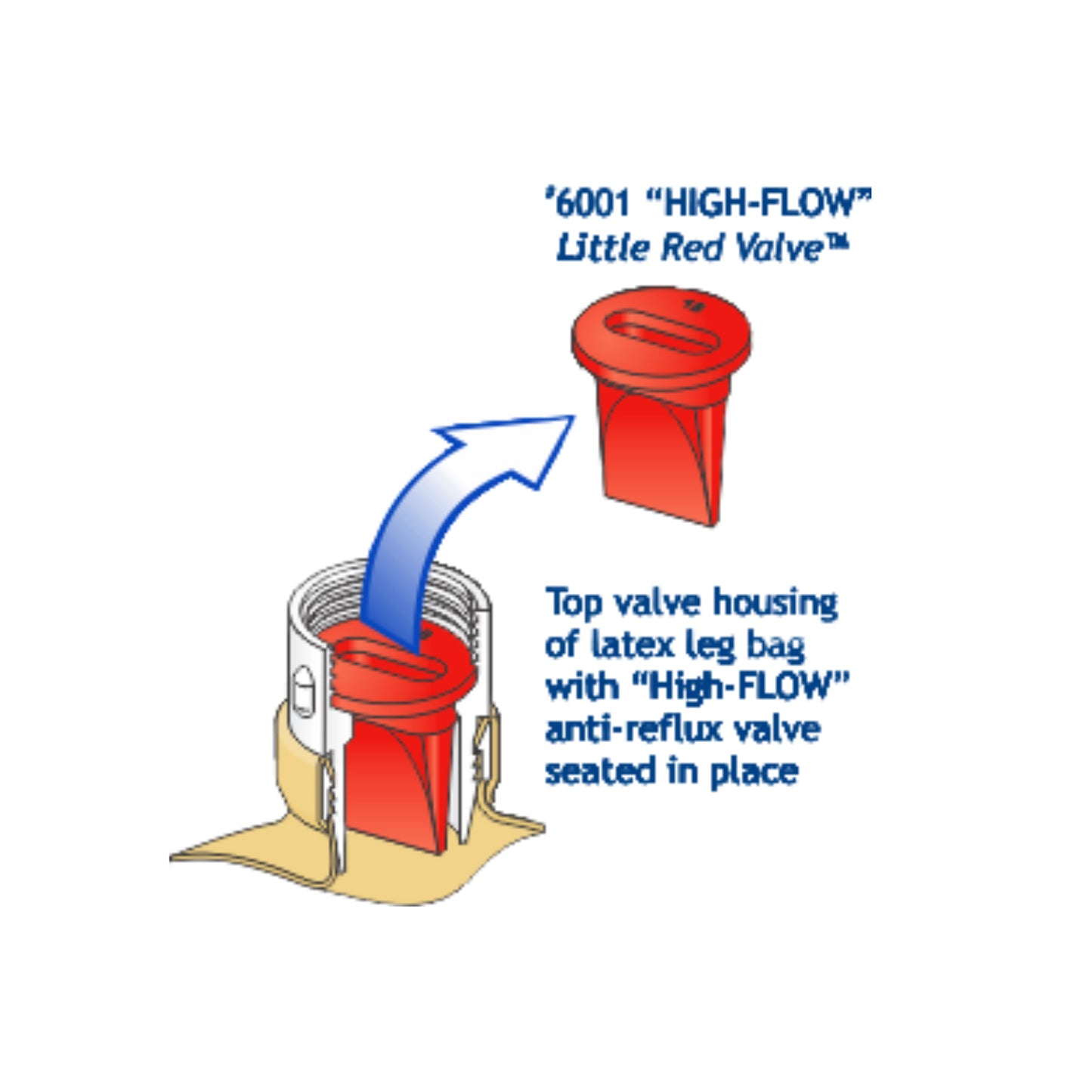 Urocare High Flow Little Red Valve (1) - First Aid Distributions